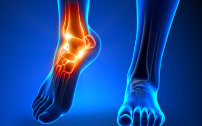 13 Types of Foot and Ankle Injuries That Shouldn’t Be Ignored