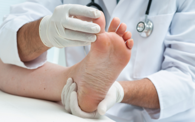 How Can Your Doctor Help Get Rid of Athlete’s Foot?