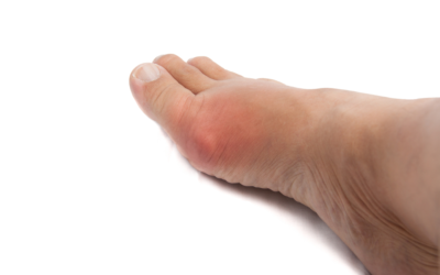 How Do You Get Rid of Pain in Your Big Toe?