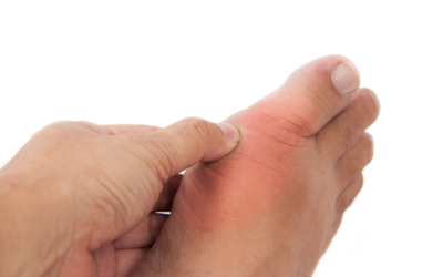 8 Possible Reasons for Big Toe Pain (and What to Do About Them)
