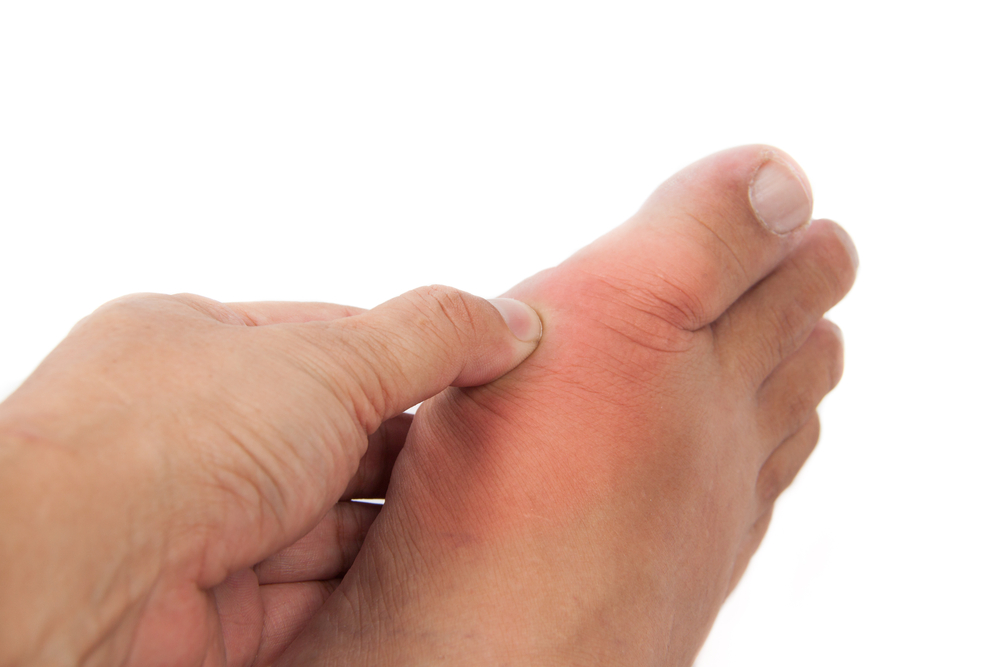 8 Possible Reasons for Big Toe Pain (and What to Do About Them)