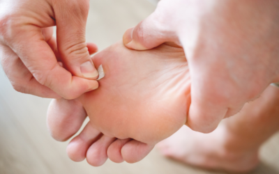 What’s the Best Way to Get Rid of Plantar Warts?