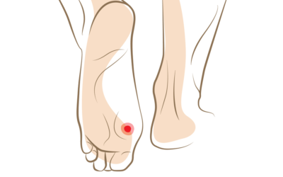 Why You Should Never Let a Foot Infection Go Untreated